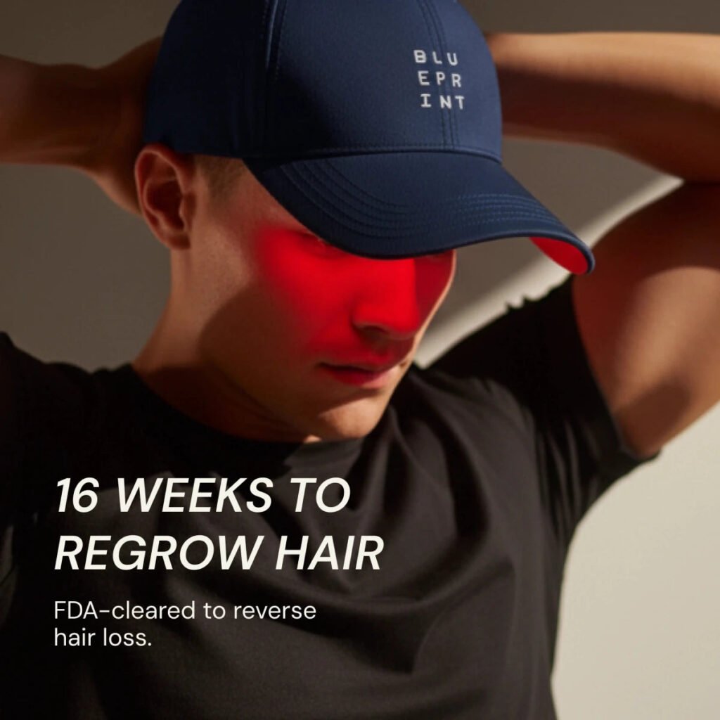 Laser Cap Hair Regrowth Results 16 Weeks